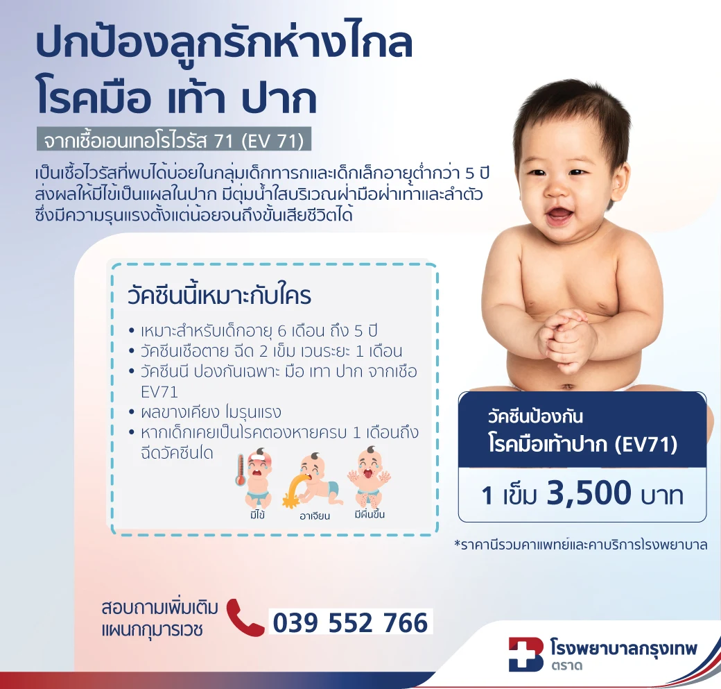 วัคซีนป้องกันโรคมือเท้าปาก (EV1) 1 เข็ม | ลดความเสี่ยงอาการรุนแรงในเด็ก