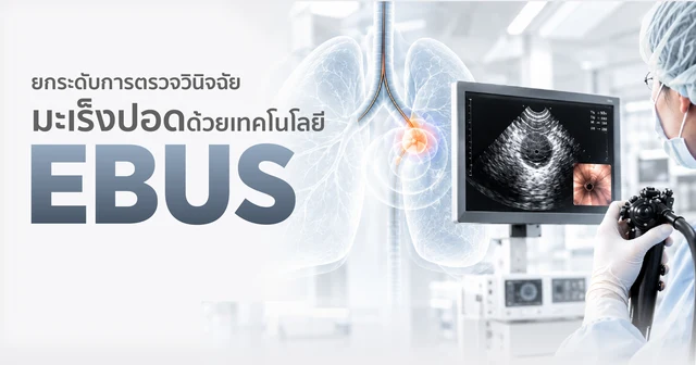 ยกระดับการตรวจวินิจฉัยมะเร็งปอดด้วยเทคโนโลยี EBUS รู้เร็ว วินิจฉัยตรงจุด วางแผนรักษาได้อย่างแม่นยำยิ่งขึ้น Image