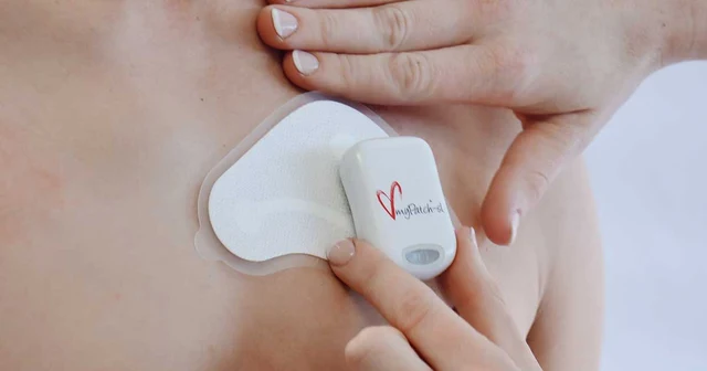 myPatch SL Holter Monitoring