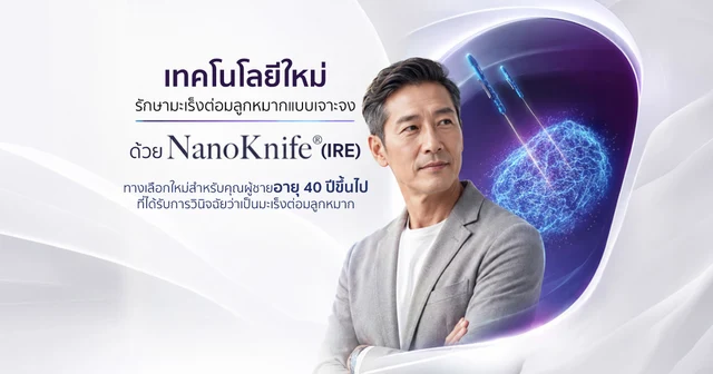 เทคโนโลยีใหม่รักษามะเร็งต่อมลูกหมากแบบเจาะจงด้วย NanoKnife (IRE)