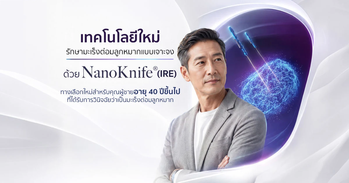เทคโนโลยีใหม่รักษามะเร็งต่อมลูกหมากแบบเจาะจงด้วย NanoKnife (IRE)