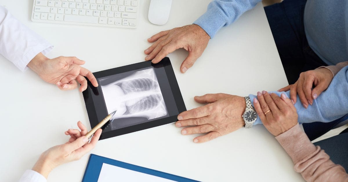ตรวจคัดกรองมะเร็งปอดด้วยเอกซเรย์ช่องอกแบบรังสีต่ำ (Low-Dose Chest CT Scan-LDCT Chest)
