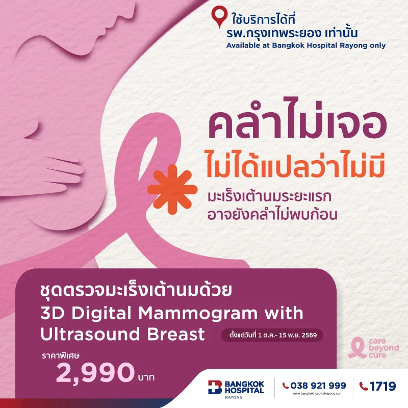 3D mammogram