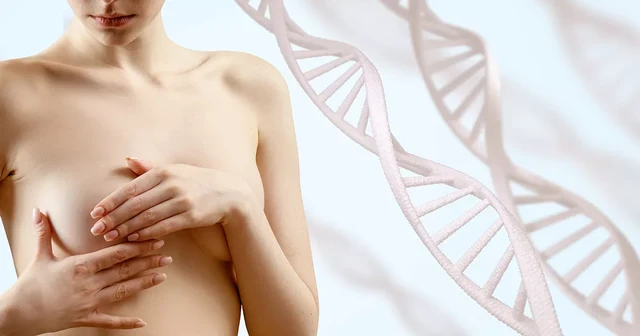 Breast Lift (Mastopexy)