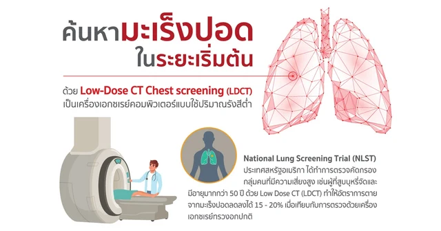 ค้นหามะเร็งปอดในระยะเริ่มต้นด้วย Low-Dose CT Chest screening (LDCT)