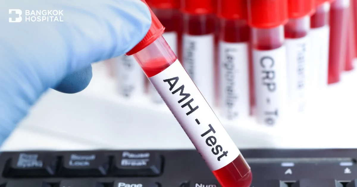 A Comprehensive Guide to Anti-Mullerian Hormone Test