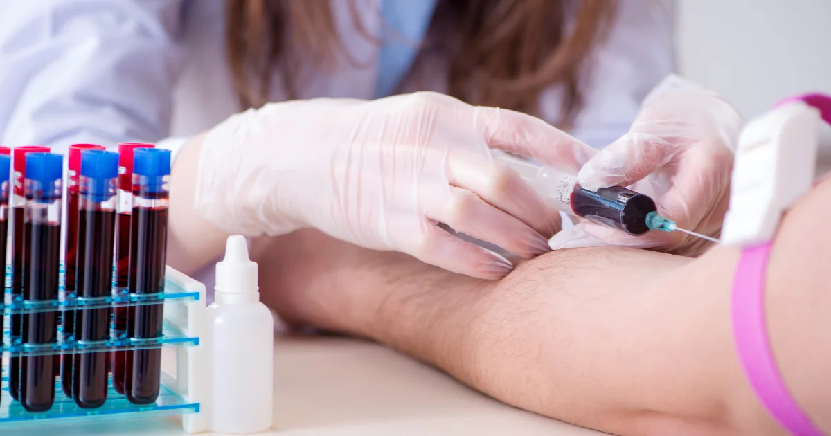 Procedure of the AMH Test