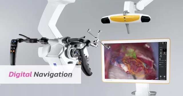นวัตกรรม NAVIGATOR เครื่องนำวิถีผ่าตัดสมอง เพิ่มความแม่นยำและความปลอดภัยในการศัลยกรรมประสาท Image