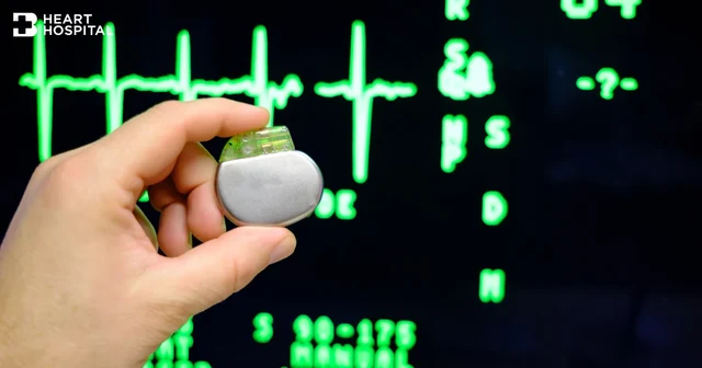 Pacemaker Implantation – A Comprehensive Guide