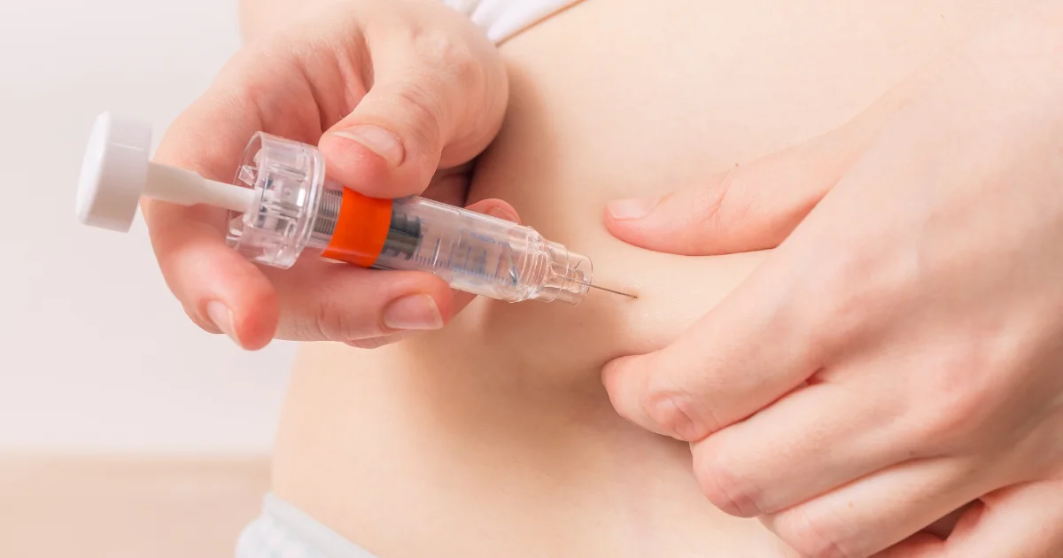 IVF Procedure
