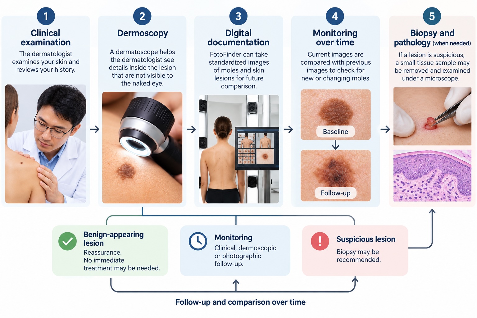 Mole check dermoscopy monitoring biopsy and pathology pathway
