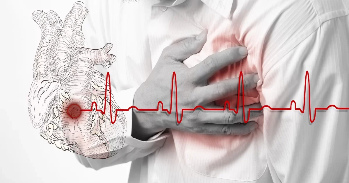 การรักษาหัวใจเต้นผิดจังหวะด้วยระบบ PFA (Pulsed Field Ablation)